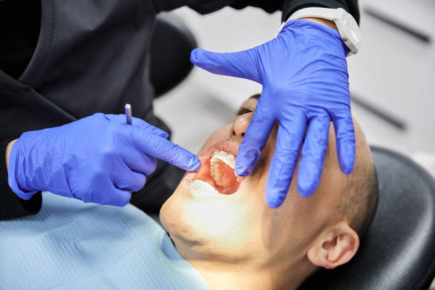 Best Knocked-Out Tooth (Avulsed Tooth) Treatment in Milton, DE